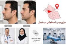 جراحی بینی استخوانی
