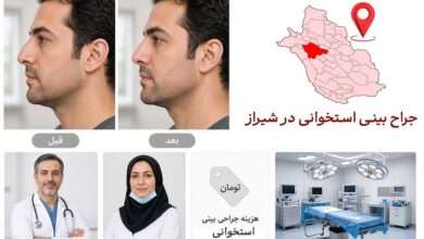 جراحی بینی استخوانی
